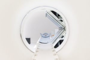 mri scan